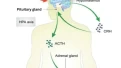 Study Links Thyroid Hormones, Blood Sugar, Blood Lipids, and BMI to the Severity of Major Depressive Disorder and Suicide Risk